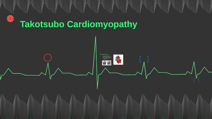 Takotsubo Cardiomyopathy By Emily Smith