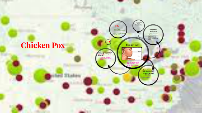 Chicken Pox by elizabeth hensley on Prezi