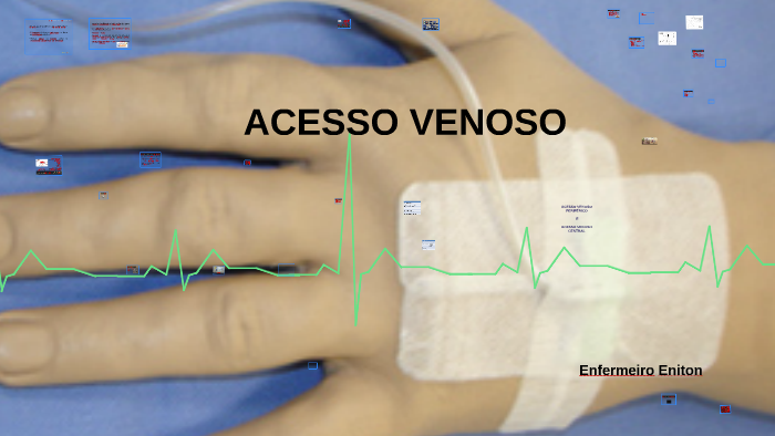 Punção de Acesso Venoso by eniton lima on Prezi