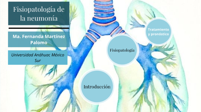 Fisiopatología de la neumonía by Fernanda Martinez on Prezi