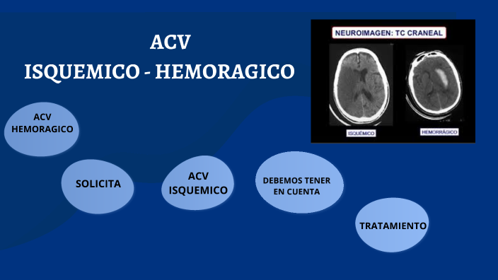 Fisiopatologia Del Acv Isquemico Y Hemorragico Pdf prezi.com