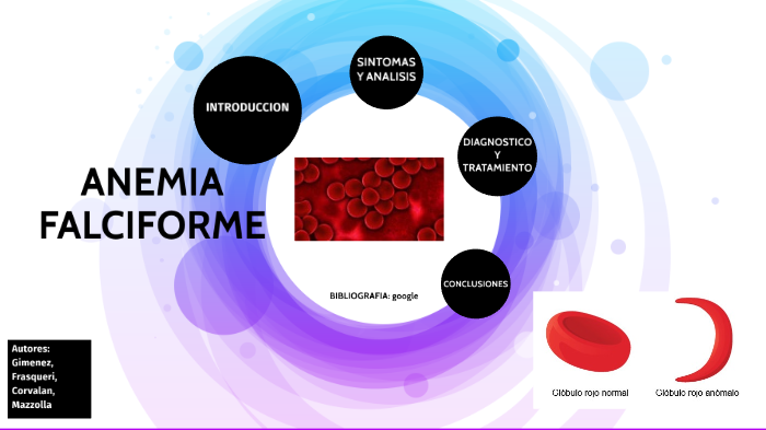 Anemia Falciforme By Lara Mazzolla