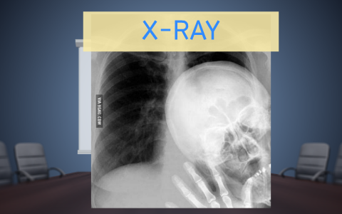 X-RAY by 유진 이. on Prezi