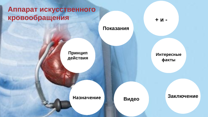 Схема системы экстракорпорального кровообращения