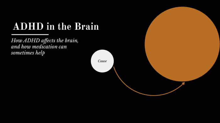 ADHD Presentation-Brain by Emma Stover on Prezi