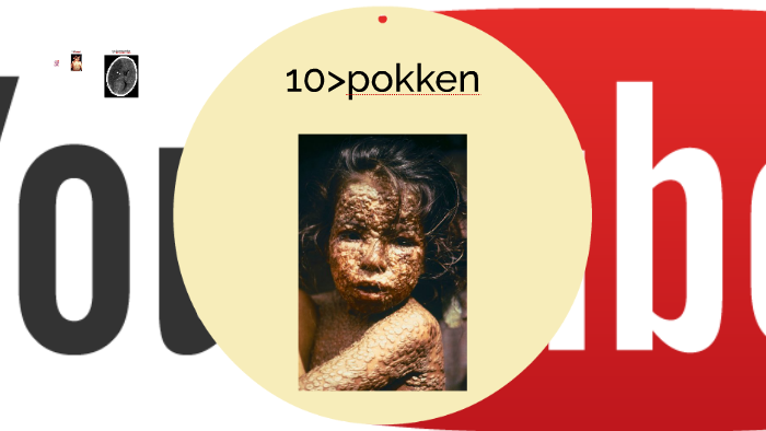 Wat Is De Ergste Ziekte Ter Wereld