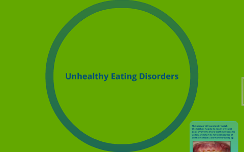 Unhealthy Eating Disorders by Michael Perry