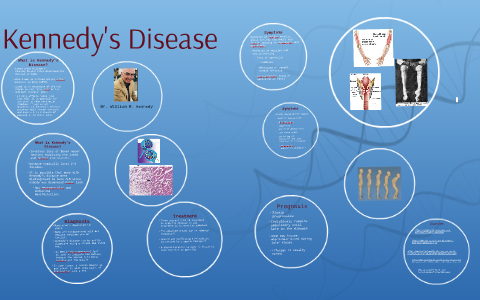 Kennedy's Disease by