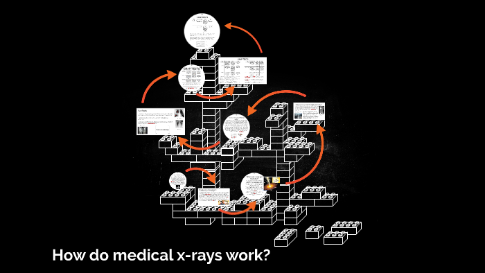 How Do Medical X Rays Work By Natalie Gulizia