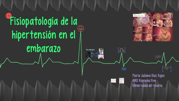 Inducción del parto para la fisiopatología de la hipertensión crónica