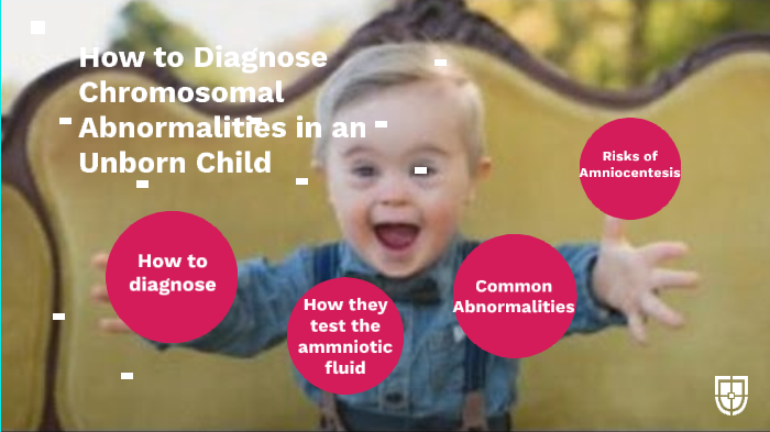 How To Diagnose Chromosomal Abnormalities Before The Baby Is Born By ...