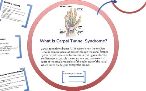 carpal tunnel syndrome, OTA interventions by Sue Bengston on Prezi