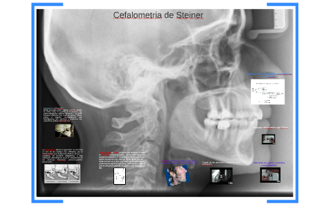 Cefalometria de Steiner by Leticia Orozco Cuanalo on Prezi