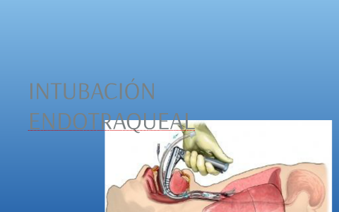 INTUBACIÓN ENDOTRAQUEAL by Stefy Rodriguez on Prezi