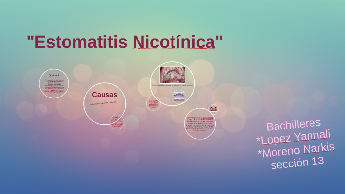 estomatitis nicotínica