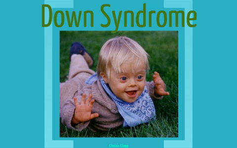 Downs Syndrome By Chelsie Clapp