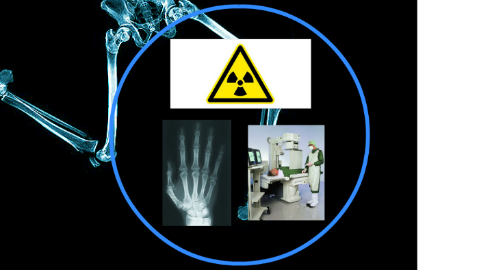 Radioaktivität In Der Medizin Powerpoint Radioaktive Strahlung in der Medizin by Peggy Mundani on Prezi