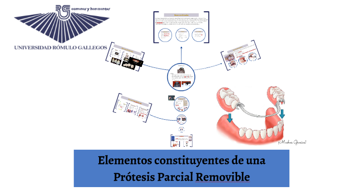 Elementos constituyentes de una Prótesis Parcial Removible by oriana