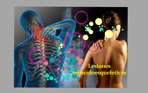 Lesiones musculoesqueleticas by Neptali Chavira on Prezi