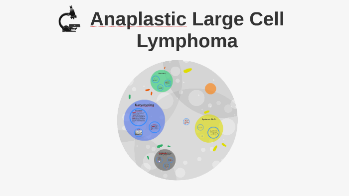 Anaplastic Large Cell Lymphoma by Cathy kilada