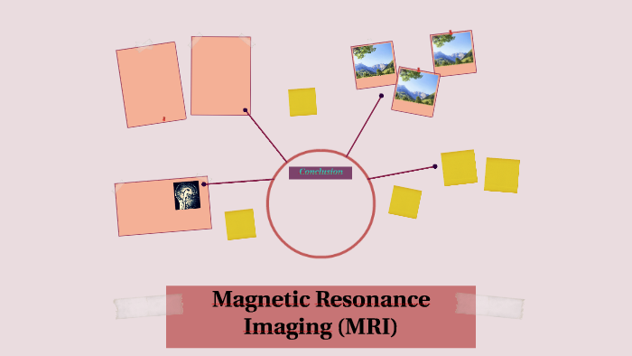Magnetic Resonance Imaging (MRI) by abeer ameereh on Prezi