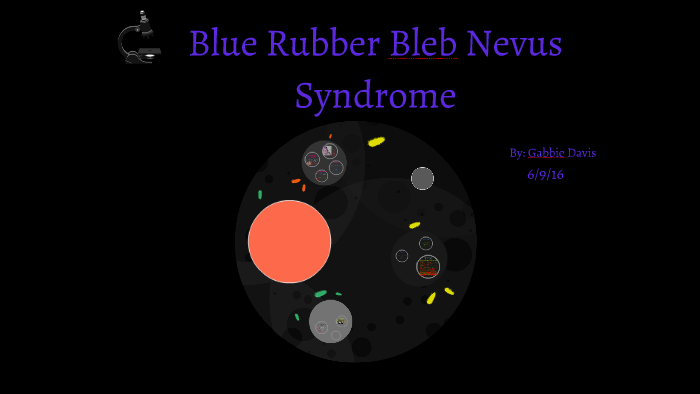 Blue Rubber Bleb Nevus Syndrome By Gabbie Davis On Prezi 1761