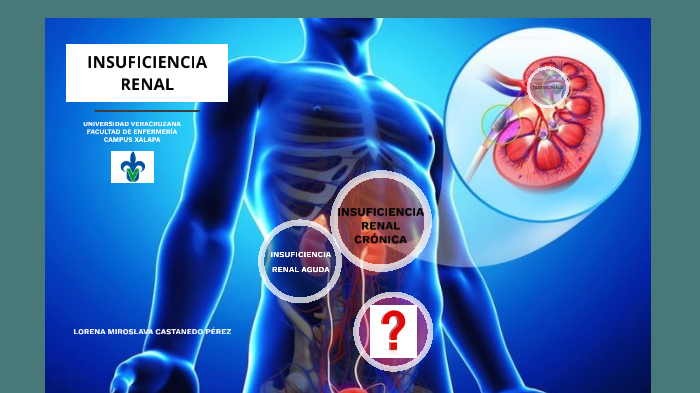 Insuficiencia Renal By Lore Castanedo Pérez