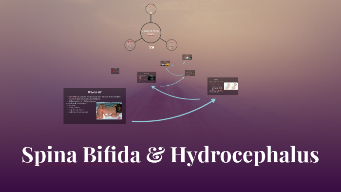 Spina Bifida And Hydrocephalus By Hannah Kunkel On Prezi Next