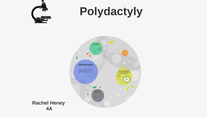 Polydactyly Pedigree Chart