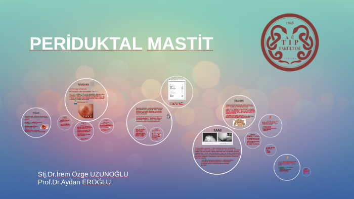 Periduktal Mastit By Irem Ozge Uzunoglu