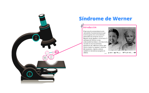Síndrome de Werner by Daniela Mejia on Prezi