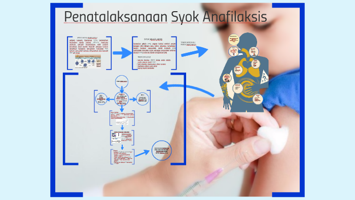 Penatalaksanaan Syok Anafilaktik By Alfian Aditia On Prezi