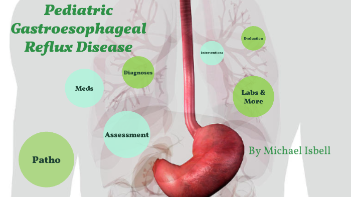 GERD Concept Map by Michael Isbell on Prezi