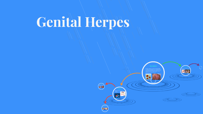 Genital Herpes By Yusra Fatima On Prezi