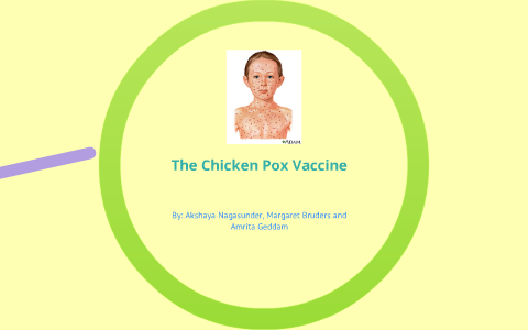 The Chicken Pox Vaccine by Akshaya Nagasunder on Prezi