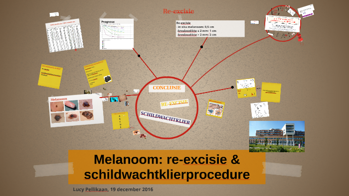 Melanoom: Re-excisie & Schildwachtklierproedure By Pelik 004 On Prezi