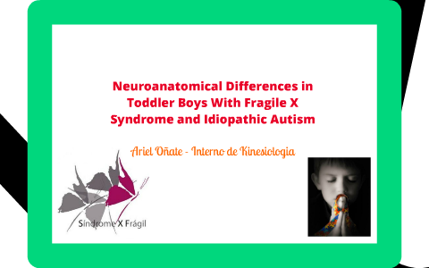 Neuroanatomical Differences in Toddler Boys With Fragile X Syndrome and ...