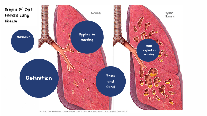 cystic fibrosis lungs diagram