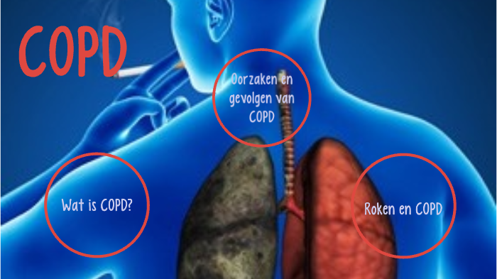 COPD by Martine de Kam on Prezi