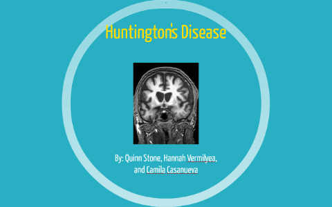 Huntington's Disease by Quinn Stone on Prezi