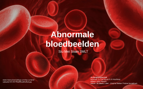 Abnormale bloedbeelden by Siu Mei Soan on Prezi