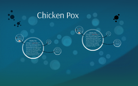 Chicken Pox by Justin Mooo on Prezi