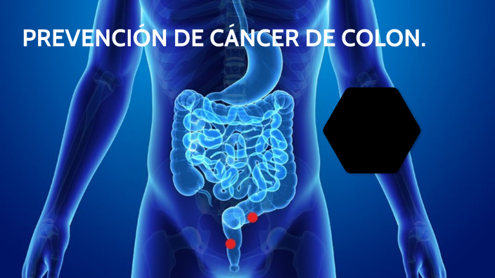 PREVENCIÓN DE CÁNCER DE COLON. by Misbel Tavarez on Prezi