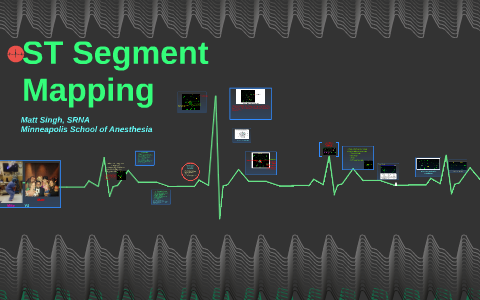 ST Segment Mapping by Matt Singh on Prezi
