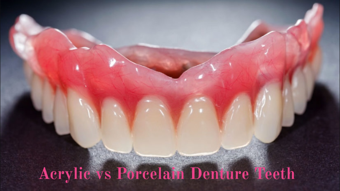 Acrylic vs Porcelain Denture Teeth by jess si