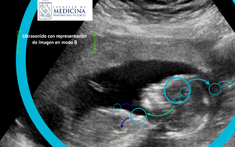 Ultrasonido Con Representación De Imagen En Modo B By Gina Rocha On Prezi