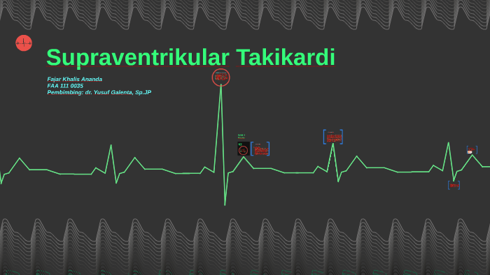 Supraventrikular Takikardi By Fajar Khalis Ananda On Prezi