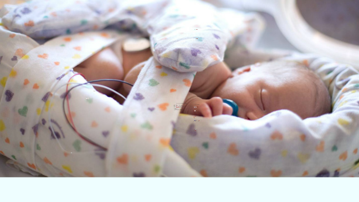 Therapeutic Positioning In The Nicu By Kim Schaefle On Prezi