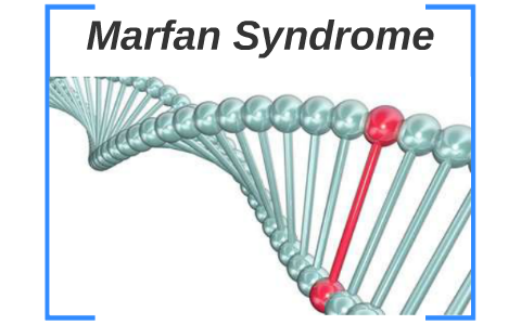 Marfan Syndrome by judy voors on Prezi