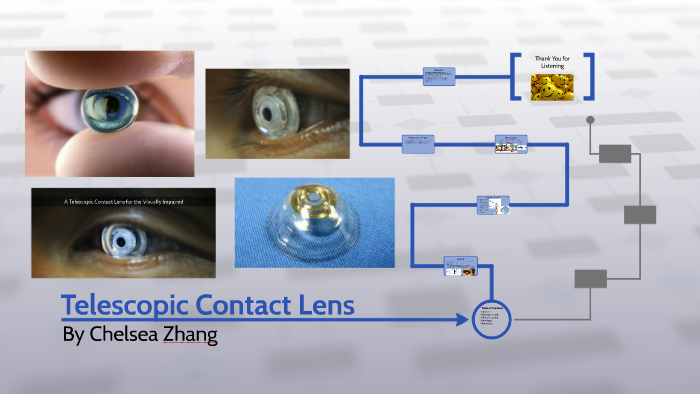 Telescopic Contact Lens By Chelsea Zhang
